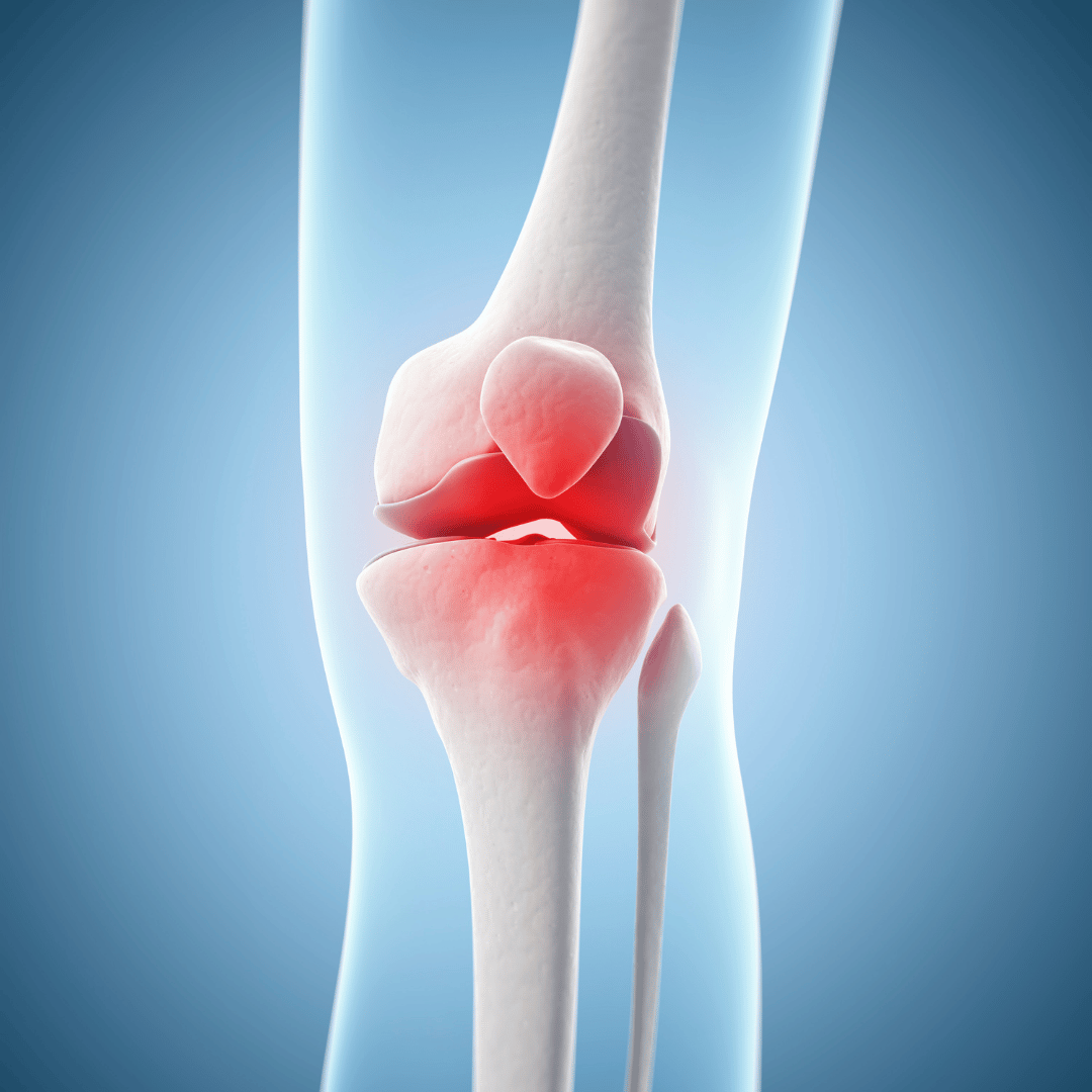 Knie-Fokus Check
